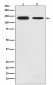 Growth hormone receptor Antibody