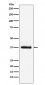 Parathyroid Hormone Antibody