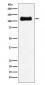 ApoER2 Antibody