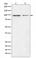 Dynamin 1 Antibody