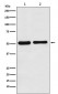 Fascin Antibody