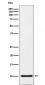 RANTES Antibody