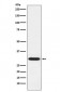 GCLM Antibody