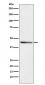 RRM2 Antibody