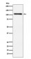 Protein Kinase D2 Antibody