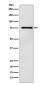 DCP1A Antibody