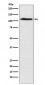 CHD1L Antibody