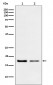 Destrin Antibody