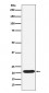 SOCS2 Antibody