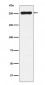 WNK1 Antibody