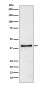 TRIB3 Antibody