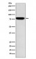 RANK Antibody