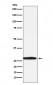 Carbonic Anhydrase 1 Antibody