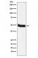 Neurokinin 1 Receptor Antibody