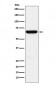 Methionine Aminopeptidase 2 Antibody