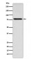 Coilin Antibody
