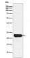 Glutathione Peroxidase 2 Antibody