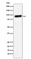 RRM1 Antibody