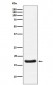 Cardiac Troponin C Antibody