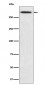 SPTA1 Antibody