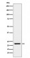 TAGLN Antibody