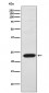 TNNI2 Antibody