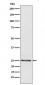 Lysophospholipase 1 Antibody