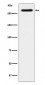 SorLA Antibody