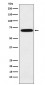 IKZF3 Antibody