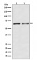 Activin Receptor Type IIB/ACVR2B Antibody