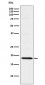 TOMM22/TOM22 Antibody