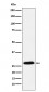 GSC Antibody