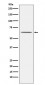 Nogo Receptor Antibody