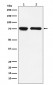IL7R alpha/CD127 Antibody
