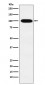 VPS18  Antibody