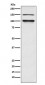 ATP1A3 Antibody