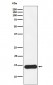 CRABP1 Antibody