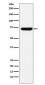 ZBTB7A Antibody