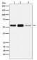 ATGL / PNPLA2 Antibody
