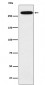 alpha 1 Spectrin Antibody