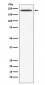 SMCHD1 Antibody