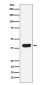 HLA B7 Antibody