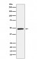NR2E1 Antibody