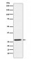 SRD5A2 Antibody