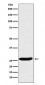 CLPP Antibody