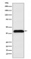 M6PR Antibody