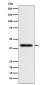 TMOD2  Antibody