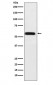 ANGPTL3 Antibody