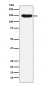 Desmoglein 3 Antibody
