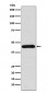 SSTR5 Antibody